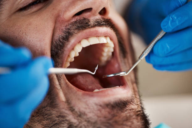 Best Sedation Dentistry  in Trappe, MD